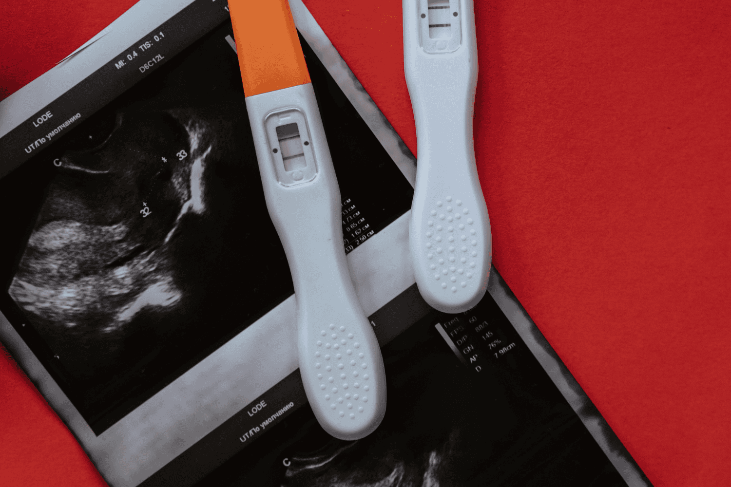 HyperSperm: el avance argentino que podría revolucionar la fertilización in vitro