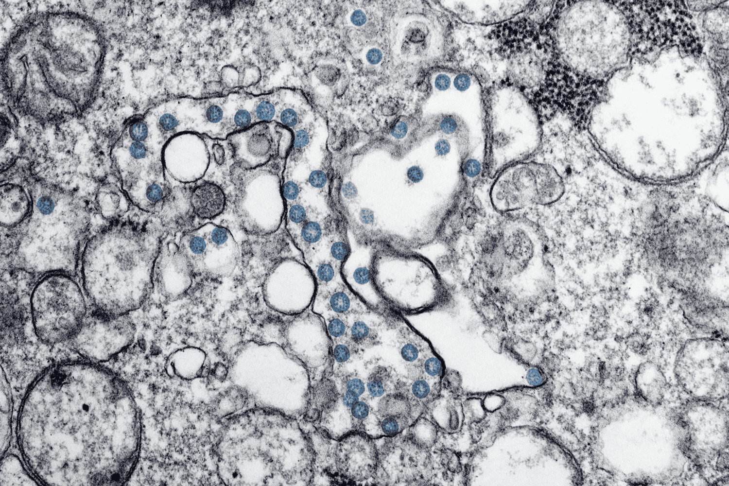 Así entrenamos bacterias para eliminar medicamentos del agua contaminada