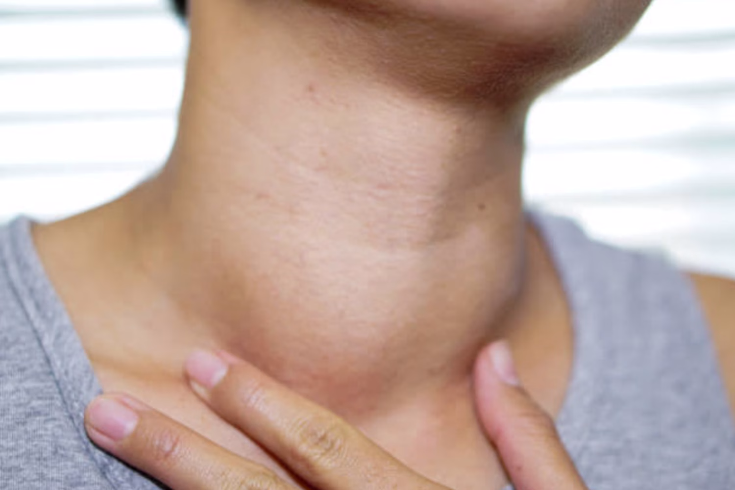 Cáncer de tiroides: síntomas, diagnóstico y la importancia de la detección temprana