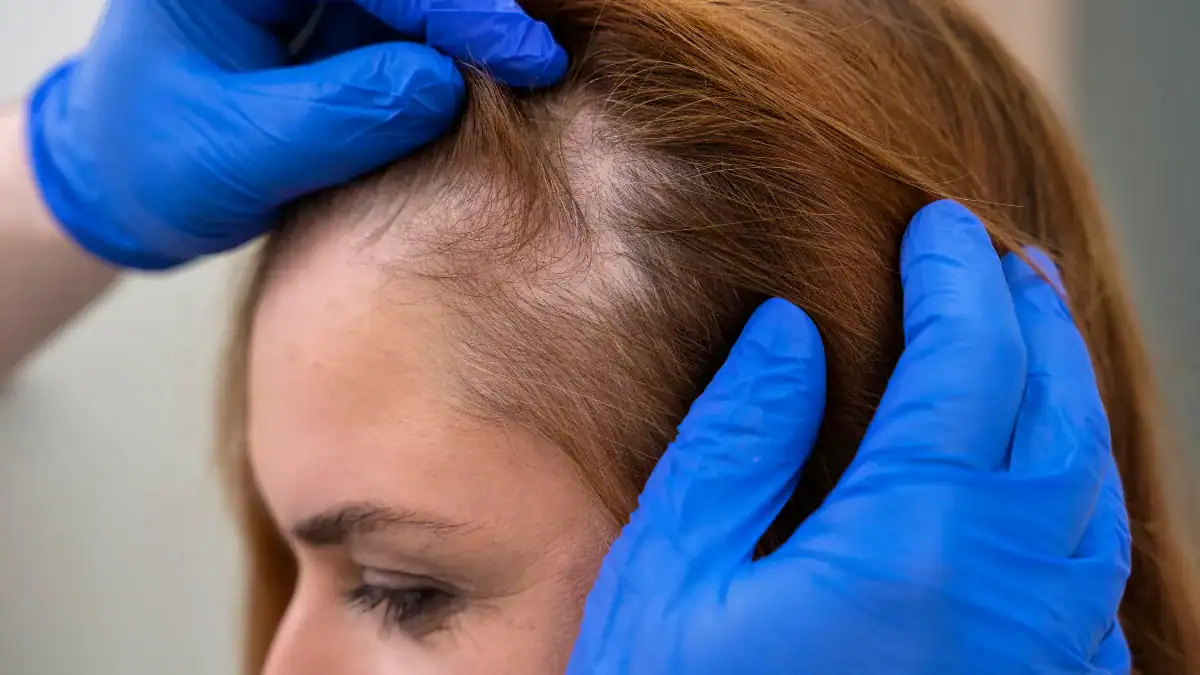 La zona que casi nadie protege del sol y donde el melanoma puede pasar años oculto